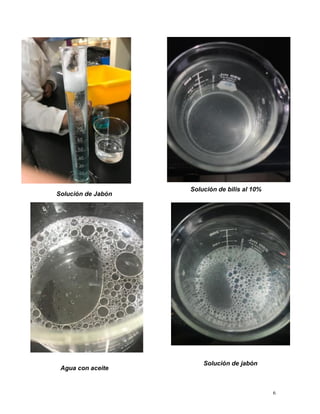 6
Solución de Jabón
Solución de bilis al 10%
Agua con aceite
Solución de jabón
 