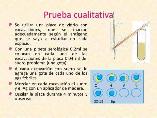 Paratifico B Positivo Que Significa - abstractor