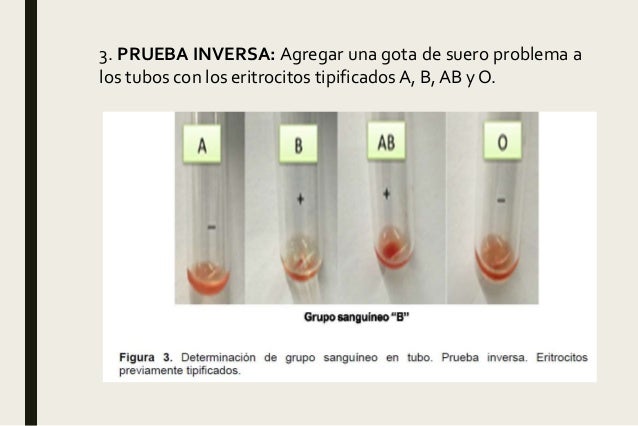 Práctica 5. GRUPOS SANGUÍNEOS