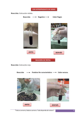 “Todo esveneno,Nadaesveneno.Tododepende de ladosis”. 6
Reacción: Coloración violeta.
Reacción Negativo Color Negro
Reacción: Coloración rojo.
Reacción Positivo No característico Color oscura.
CON NITROPRUSIATO DE SODIO.
REACCIÓN DE FRITSH.
ANTES
ANTES
DESPUÉS
DESPUÉS
 