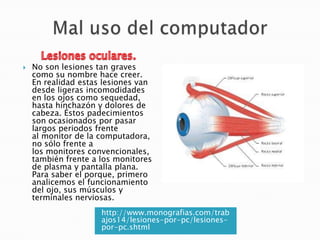 

No son lesiones tan graves
como su nombre hace creer.
En realidad estas lesiones van
desde ligeras incomodidades
en los ojos como sequedad,
hasta hinchazón y dolores de
cabeza. Éstos padecimientos
son ocasionados por pasar
largos periodos frente
al monitor de la computadora,
no sólo frente a
los monitores convencionales,
también frente a los monitores
de plasma y pantalla plana.
Para saber el porque, primero
analicemos el funcionamiento
del ojo, sus músculos y
terminales nerviosas.
http://www.monografias.com/trab
ajos14/lesiones-por-pc/lesionespor-pc.shtml

 