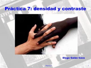 Práctica 7 1
Práctica 7: densidad y contraste
Diego Galán Cava
 