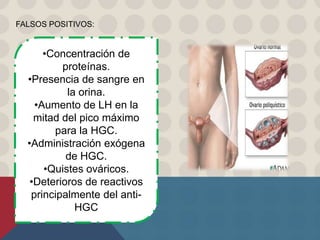 •Concentración de
proteínas.
•Presencia de sangre en
la orina.
•Aumento de LH en la
mitad del pico máximo
para la HGC.
•Administración exógena
de HGC.
•Quistes ováricos.
•Deterioros de reactivos
principalmente del anti-
HGC
FALSOS POSITIVOS:
 