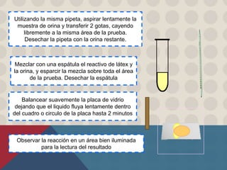 Observar la reacción en un área bien iluminada
para la lectura del resultado
Balancear suavemente la placa de vidrio
dejando que el liquido fluya lentamente dentro
del cuadro o circulo de la placa hasta 2 minutos
Mezclar con una espátula el reactivo de látex y
la orina, y esparcir la mezcla sobre toda el área
de la prueba. Desechar la espátula
Utilizando la misma pipeta, aspirar lentamente la
muestra de orina y transferir 2 gotas, cayendo
libremente a la misma área de la prueba.
Desechar la pipeta con la orina restante.
 