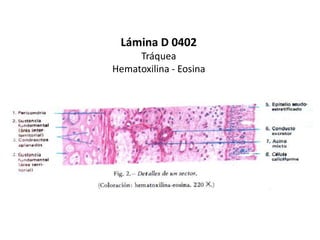 Lámina D 0402
     Tráquea
Hematoxilina - Eosina
 
