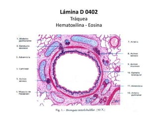 Lámina D 0402
     Tráquea
Hematoxilina - Eosina
 