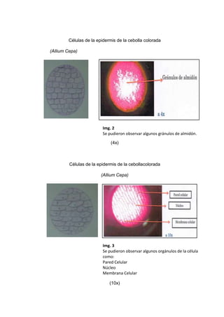 Células de la epidermis de la cebolla colorada
(Allium Cepa)

Img. 2
Se pudieron observar algunos gránulos de almidón.
(4x)

Células de la epidermis de la cebollacolorada
(Allium Cepa)

Img. 3
Se pudieron observar algunos orgánulos de la célula
como:
Pared Celular
Núcleo
Membrana Celular
(10x)

 
