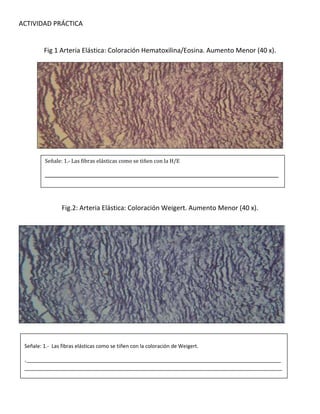 ACTIVIDAD PRÁCTICA
Fig 1 Arteria Elástica: Coloración Hematoxilina/Eosina. Aumento Menor (40 x).
Fig.2: Arteria Elástica: Coloración Weigert. Aumento Menor (40 x).
Señale: 1.- Las fibras elásticas como se tiñen con la coloración de Weigert.
._________________________________________________________________________________________
__________________________________________________________________________________________
Señale: 1.- Las fibras elásticas como se tiñen con la H/E
___________________________________________________________________
___________________________________________________________________
___________________________________________________________________
_________________________________________________________________
 