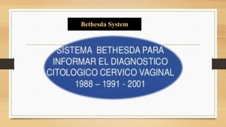 Bethesda System
 