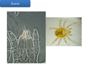 Ácaros
 