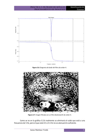 PRÁCTICA 3: FILTRADO DE SEÑALES                             Identificación de
                      PROCESAMIENTO DE IMÁGENES                                         Sistemas




                      Figura 3.6: Diagrama de bode del filtro de orden 4.




                Figura 3.7: Imagen filtrada con un filtro Butterworth de orden 4.


       Como se ve en la gráfica 3.2.6 realmente se eliminará el ruido que está a una
frecuencia de 5 Hz, pero el que está 4.5 o 5.5 Hz no se atenuará lo suficiente.


                   Jaime Martínez Verdú                                                       5
 