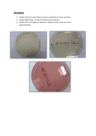 Resultados
 Medio Cled: Fermentación de lactosa. Colonias de color amarillo.
 Medio McConkey: no hay crecimiento de bacterias
 Medio CPS cromogénico: Aparecen colonias color verde son beta-
galactosidasas
 