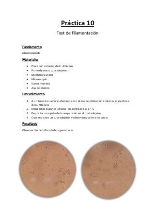 Práctica 10
Test de Filamentación
Fundamento
Observación de
Materiales
 Placa con colonias de C. Albicans
 Portaobjetos y cubreobjetos
 Mechero Bunsen
 Microscopio
 Suero muestra
 Asa de platino
Procedimiento
1. A un tubo de suero le añadimos con el asa de platino una colonia sospechosa
de C. Albicans
2. Incubamos durante 3 horas en aerobiosis a 37 ˚C
3. Depositar una gota de la suspensión en el portaobjetos
4. Cubrimos con un cubreobjetos y observamos al microscopio
Resultado
Observación de hifas y tubos germinales.
 