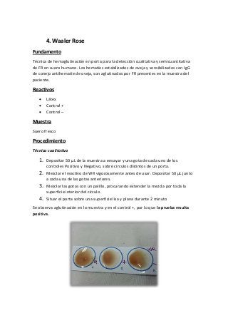 4. Waaler Rose
Fundamento
Técnica de hemaglutinación en porta para la detección cualitativa y semicuantitativa
de FR en suero humano. Los hematíes estabilizados de oveja y sensibilizados con IgG
de conejo antihematíe de oveja, son aglutinados por FR presentes en la muestra del
paciente.
Reactivos
 Látex
 Control +
 Control –
Muestra
Suero fresco
Procedimiento
Técnica cualitativa
1. Depositar 50 µL de la muestra a ensayar y una gota de cada uno de los
controles Positivo y Negativo, sobre círculos distintos de un porta.
2. Mezclar el reactivo de WR vigorosamente antes de usar. Depositar 50 µL junto
a cada una de las gotas anteriores.
3. Mezclar las gotas con un palillo, procurando extender la mezcla por toda la
superficie interior del círculo.
4. Situar el porta sobre una superficie lisa y plana durante 2 minuto
Se observa aglutinación en la muestra y en el control +, por lo que la prueba resulta
positiva.
 