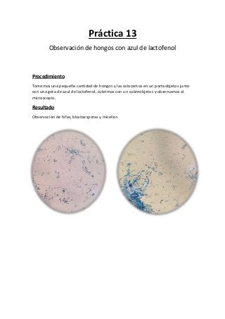 Práctica 13
Observación de hongos con azul de lactofenol
Procedimiento
Tomamos una pequeña cantidad de hongos y las colocamos en un portaobjetos junto
con una gota de azul de lactofenol, cubrimos con un cubreobjetos y observamos al
microscopio.
Resultado
Observación de hifas, blastoesporas y micelios
 