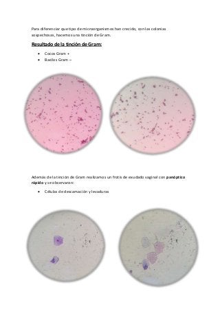 Para diferenciar que tipo de microorganismos han crecido, con las colonias
sospechosas, hacemos una tinción de Gram.
Resultado de la tinción de Gram:
 Cocos Gram +
 Bacilos Gram –
Además de la tinción de Gram realizamos un frotis de exudado vaginal con panóptico
rápido y se observaron:
 Células de descamación y levaduras
 