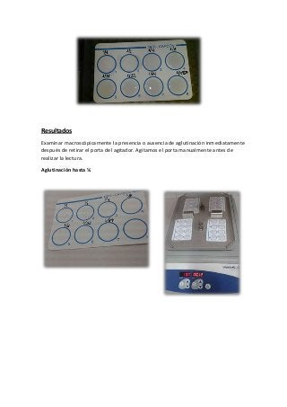 Resultados
Examinar macroscópicamente la presencia o ausencia de aglutinación inmediatamente
después de retirar el porta del agitador. Agitamos el porta manualmente antes de
realizar la lectura.
Aglutinación hasta ¼
 