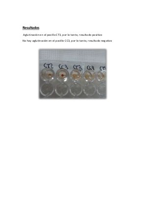 Resultados
Aglutinación en el pocillo CT3, por lo tanto, resultado positivo
No hay aglutinación en el pocillo CC3, por lo tanto, resultado negativo
 