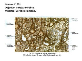 Lámina J 1001
Objetivo: Corteza cerebral.
Muestra: Cerebro Humano.
 