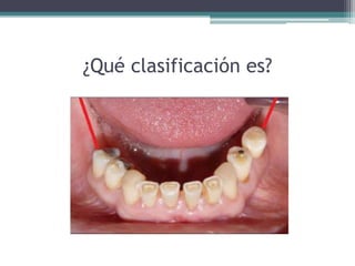 ¿Qué clasificación es?
 