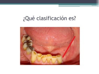 ¿Qué clasificación es?
 
