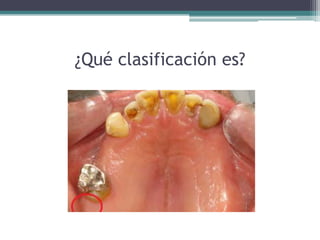 ¿Qué clasificación es?
 