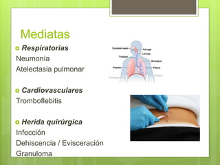 Mediatas
 Respiratorias
Neumonía
Atelectasia pulmonar
 Cardiovasculares
Tromboflebitis
 Herida quirúrgica
Infección
Dehiscencia / Evisceración
Granuloma
 