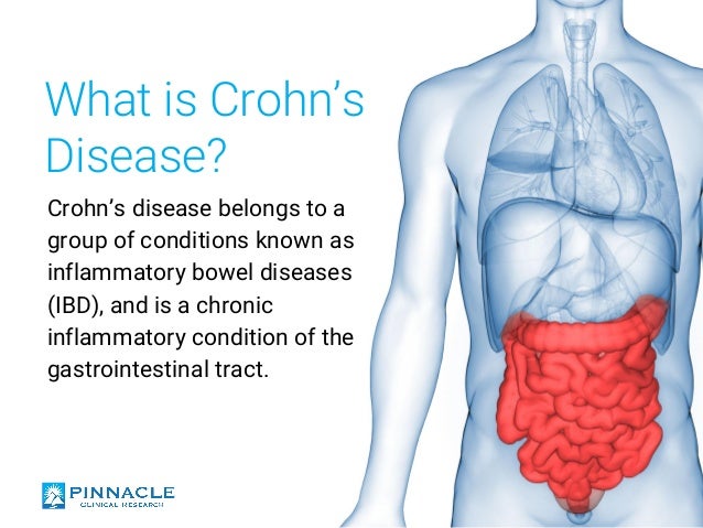 Understanding Crohn S Disease