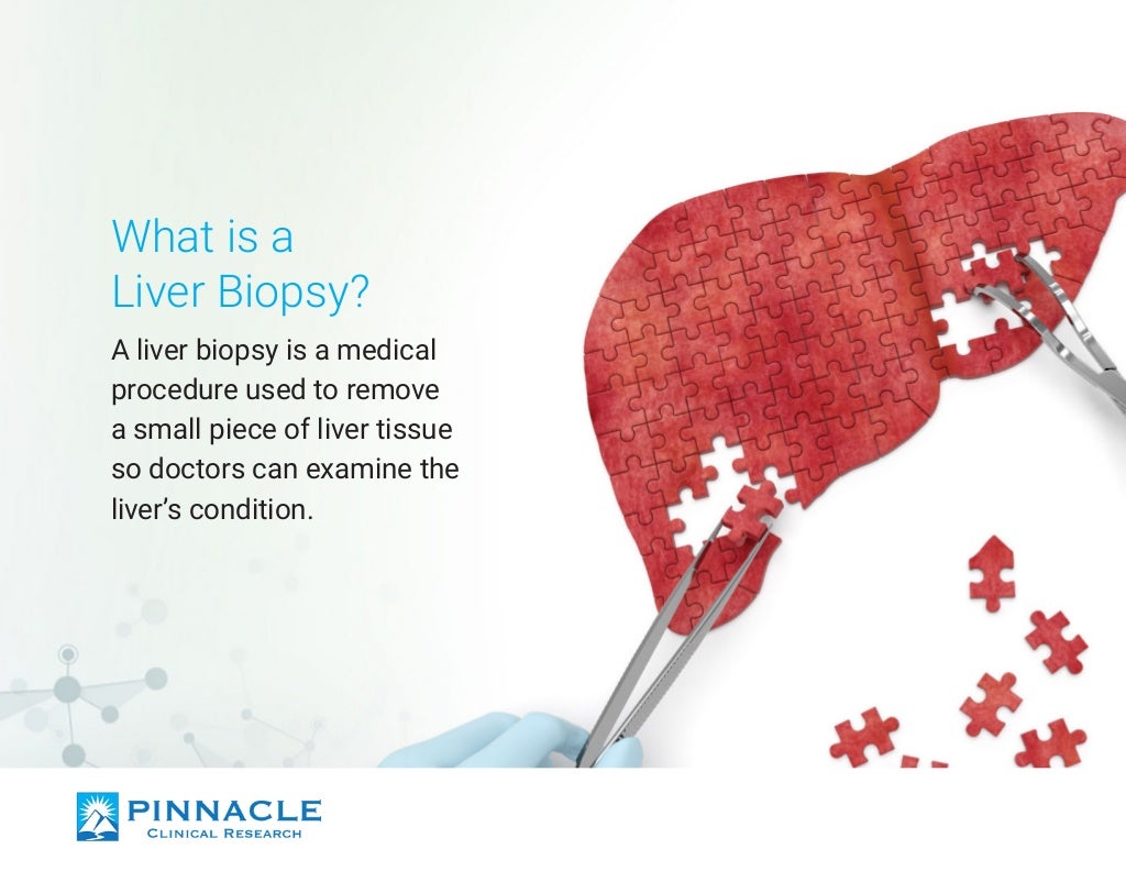 Liver Biopsy