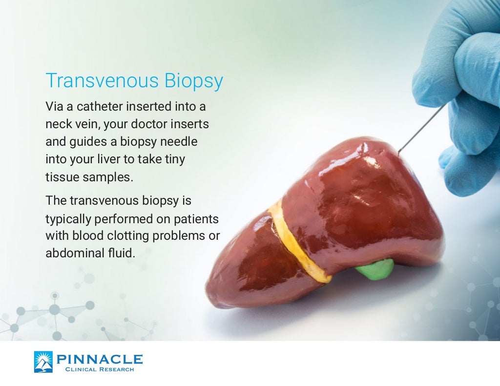 Liver Biopsy