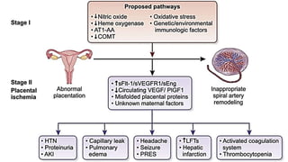 pathogenesis of Pre eclampsia | PPTX