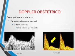 DOPPLER OBSTETRICO
• Compartimiento Materno
• Paciente embarazada anormal:
• Arterias uterinas:
• en las semana 25 o mas tarde
Índices de resistividad
elevados
Incisuras protodiastolicas
presentes
Normal Alterado
 