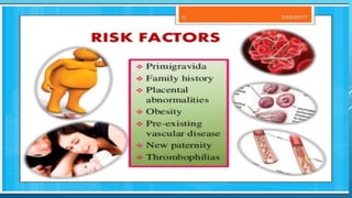 Pre eclampsia | PPTX