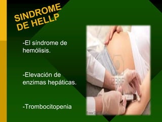 Edema.PREECLAMPSIA  SEVERACUADRO CLINICOCefalea, alteraciones visuales o cerebrales persistentesEpigastralgiaRestricción en el crecimiento intrauterino.OligohidramniosOliguria≤500 ml en 24 horasEdema agudo de pulmónDolor en hipocondrio derecho.Presión sistolica > o = a 160 mmHg. O diastólica > o = a 110 mm HgProteinuria mayor o igual a 2g en orina de 24 hrs.Creatinina sérica > 1.2 mg/dl Trombocitopenia ≤ 150000 cel/mm3     deshidrogenasa láctica ≥  600 UI.Elevación al doble de la transaminasa glutámico oxalacética (TGO) 