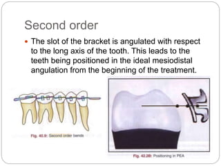 Second order
 The slot of the bracket is angulated with respect
to the long axis of the tooth. This leads to the
teeth being positioned in the ideal mesiodistal
angulation from the beginning of the treatment.
 