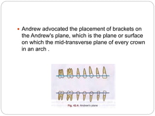  Andrew advocated the placement of brackets on
the Andrew's plane, which is the plane or surface
on which the mid-transverse plane of every crown
in an arch .
 