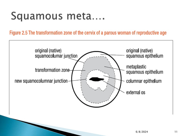 Pre-invasive Lesions of the Lower Genital Tract.pptx
