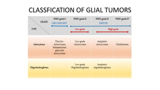 Pre-managment of Low Grade Glioma- low grade glioma | PPTX