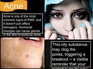 Acne
Acne is one of the most
common signs of PMS, and
it doesn't just affect
teenagers. Hormonal
changes can cause glands
in the skin to produce more
sebum.

                              This oily substance
                              may clog the
                              pores, triggering a
                              breakout -- a visible
                              reminder that your
 
