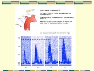 Pre operative, non-invasive cardiac output measurement | PPT