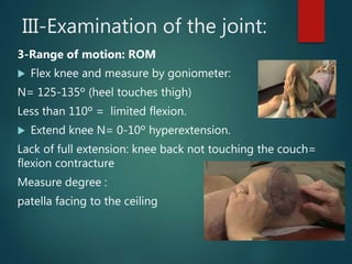 Preoperative preparation of total knee arthroplasty | PPTX