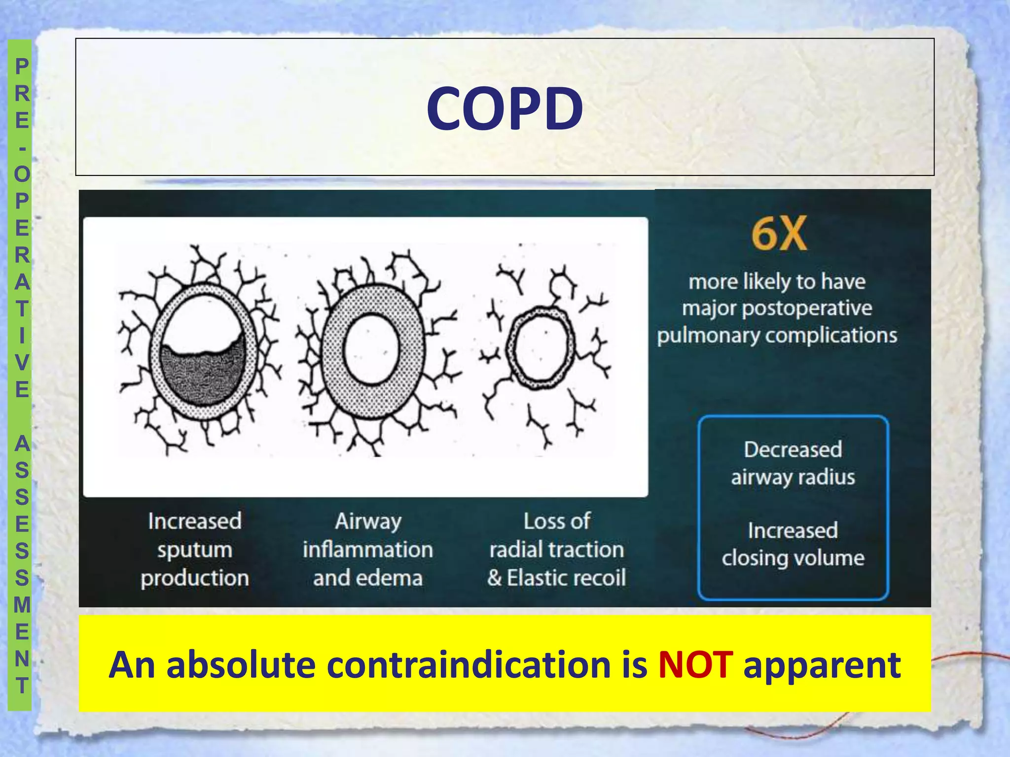 Pre operative pulmonary evaluation 2019 | PPTX