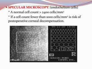  SPECULAR MICROSCOPY: (endothelium cells)
* A normal cell count > 2400 cells/mm2
* If a cell count fewer than 1000 cells/mm2 is risk of
postoperative corneal decompensation.
 