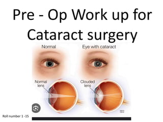 Pre Operative Work Up Pre-Op_Workspace_Cataract_Surgery_Updatedpptx_202_250728_210419.pdf