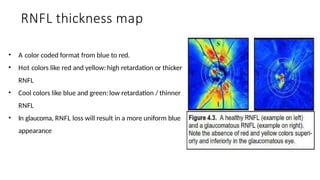 Advanced Diagnostic Techniques for Early Detection of Pre-Perimetric ...