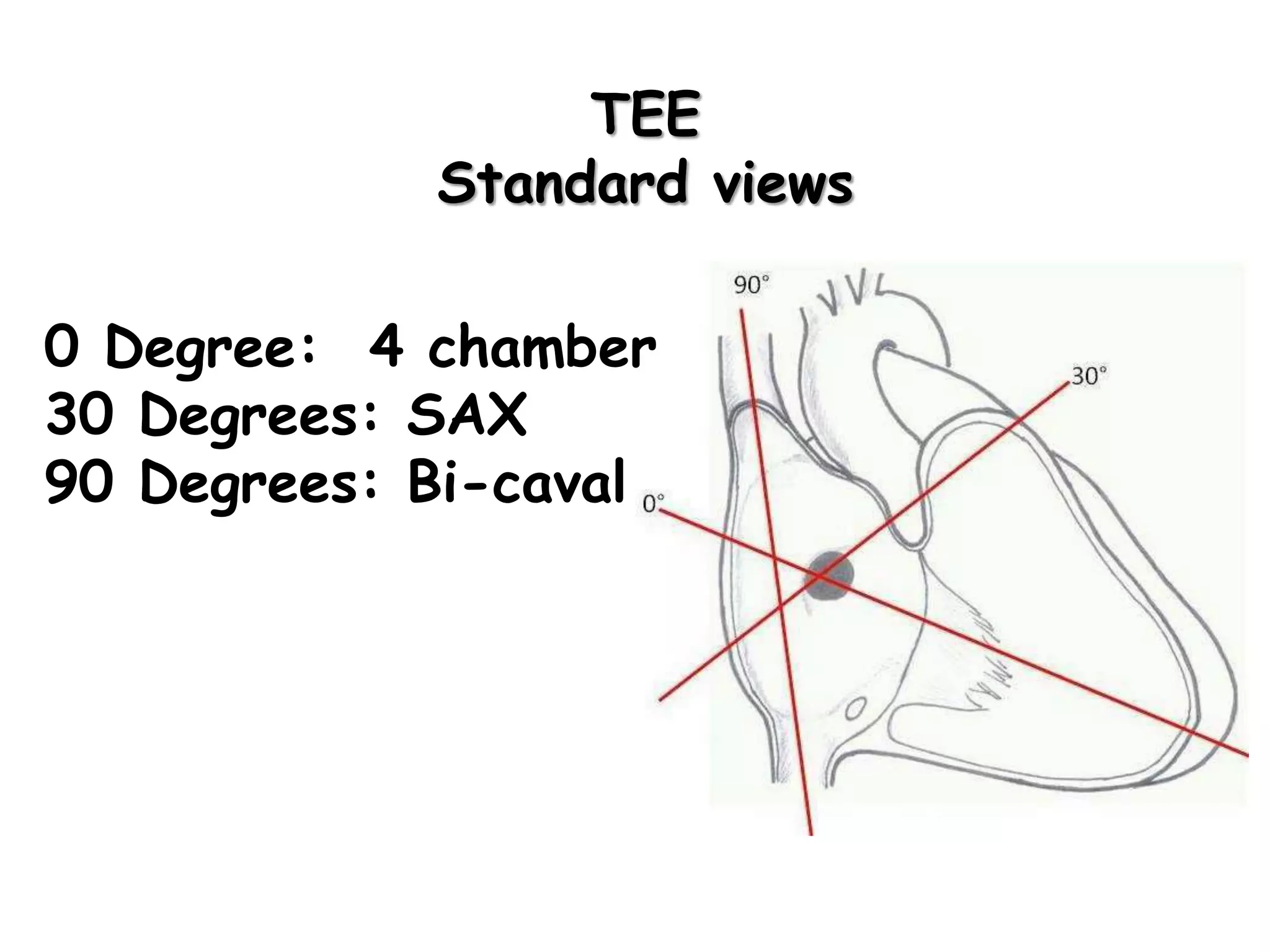 TEE
Standard views
0 Degree: 4 chamber
30 Degrees: SAX
90 Degrees: Bi-caval
 