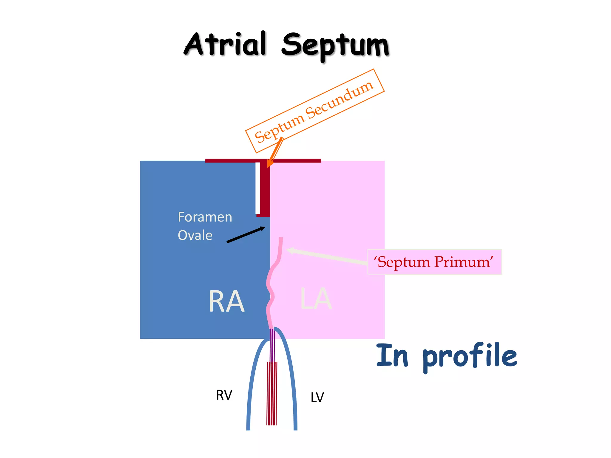 RA LA
Atrial Septum
Foramen
Ovale
In profile
RV LV
‘Septum Primum’
 