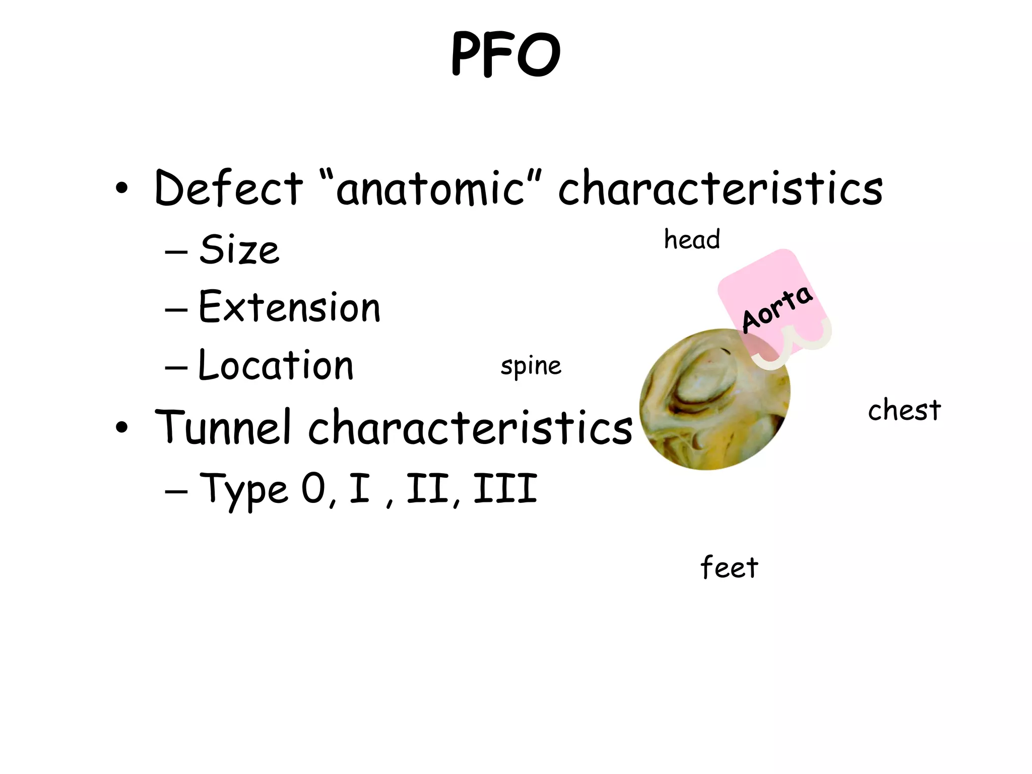PFO
• Defect “anatomic” characteristics
– Size
– Extension
– Location
• Tunnel characteristics
– Type 0, I , II, III
chest
spine
head
feet
 