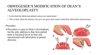 OBWEGESER’S MODIFICATION OF DEAN’S
ALVEOLOPLASTY
• In this both the labial and palatal cortices are repositioned
• This is done when the anterior over jet is too gross that cannot reduced by labial plate repositioning
Procedure
Procedure is same to Dean’s alveoloplasty
but the only addition is that, here palatal
plate is fractured too at its base and
repositioned with labial plate in palatal
direction
18
 