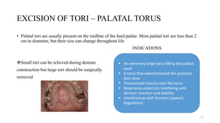 EXCISION OF TORI – PALATAL TORUS
• Palatal tori are usually present on the midline of the hard palate. Most palatal tori are less than 2
cm in diameter, but their size can change throughout life
INDICATIONS
Small tori can be relieved during denture
construction but large tori should be surgically
removed
 An extremely large torus filling the palatal
vault
 A torus that extend beyond the posterior
dam area
 Traumatized mucosa over the torus
 Deep bony undercuts interfering with
denture insertion and stability
 Interferences with function (speech,
deglutition)
22
 